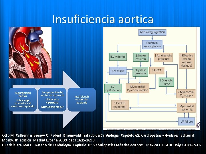 Insuficiencia aortica Regurgitación aórtica Sobrecarga volumétrica al ventrículo izquierdo Compensación del Ventrículo izquierdo Dilatación