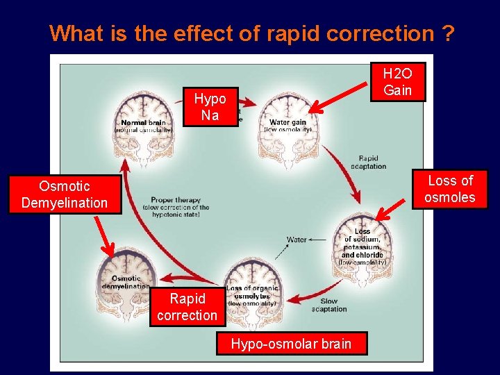 What is the effect of rapid correction ? H 2 O Gain Hypo Na