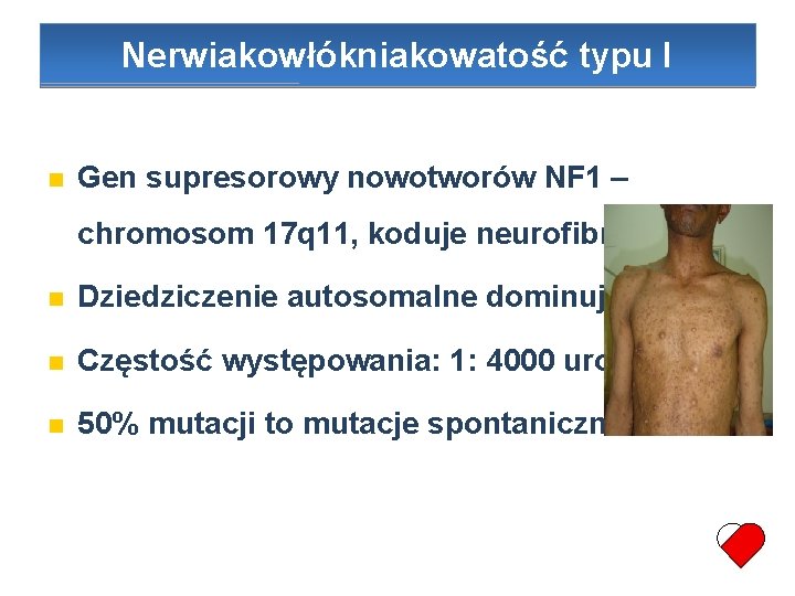 Nerwiakowłókniakowatość typu I Gen supresorowy nowotworów NF 1 – chromosom 17 q 11, koduje