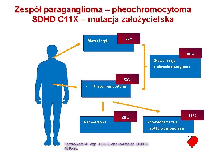 Zespół paraganglioma – pheochromocytoma SDHD C 11 X – mutacja założycielska Głowa i szyja