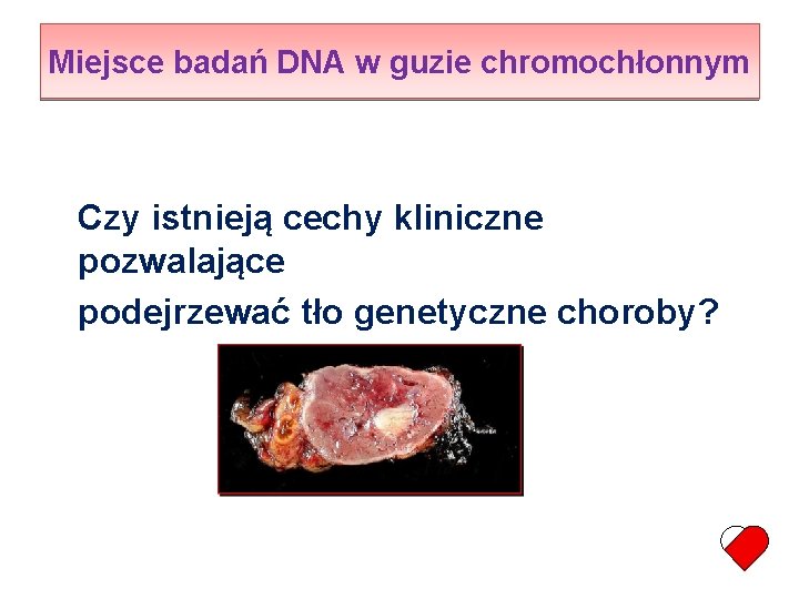 Miejsce badań DNA w guzie chromochłonnym Czy istnieją cechy kliniczne pozwalające podejrzewać tło genetyczne