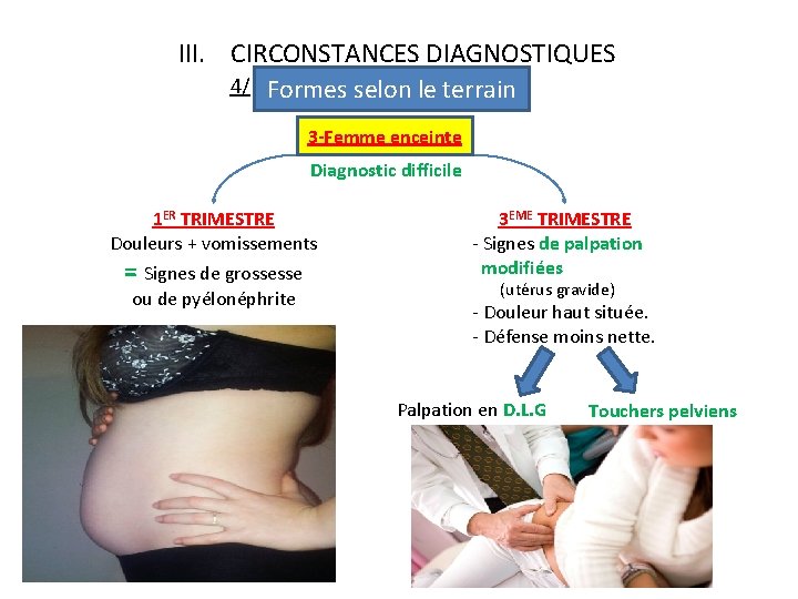 III. CIRCONSTANCES DIAGNOSTIQUES 4/ Formes selon le terrain 3 -Femme enceinte Diagnostic difficile 1