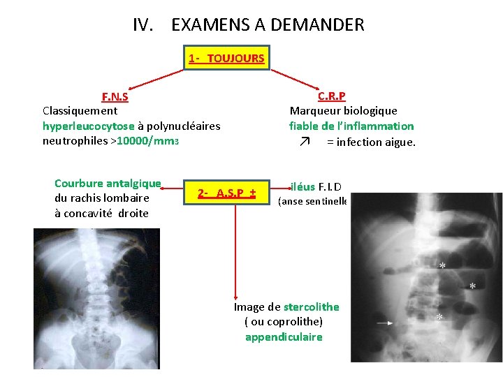 IV. EXAMENS A DEMANDER 1 - TOUJOURS C. R. P Marqueur biologique fiable de