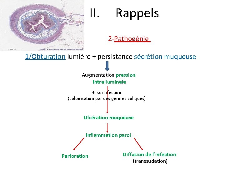 II. Rappels 2 -Pathogénie 1/Obturation lumière + persistance sécrétion muqueuse Augmentation pression Intra-luminale +