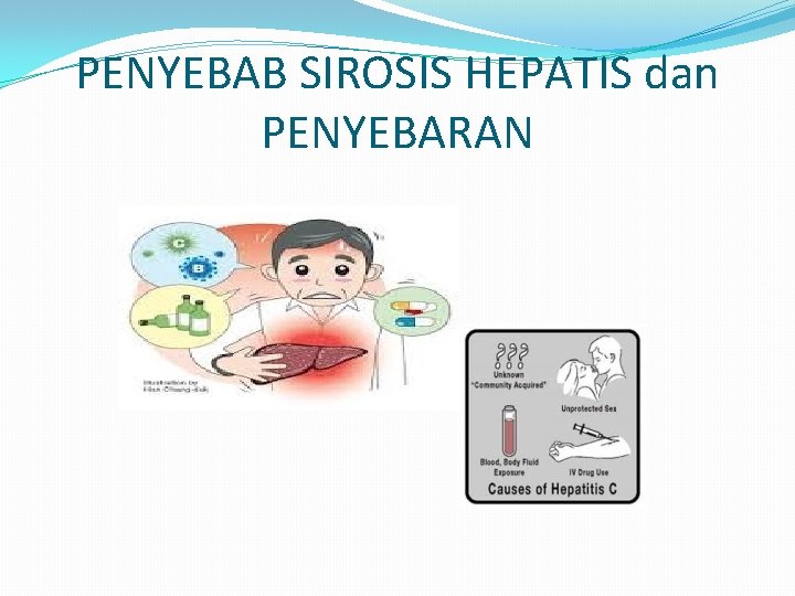 PENYEBAB SIROSIS HEPATIS dan PENYEBARAN 