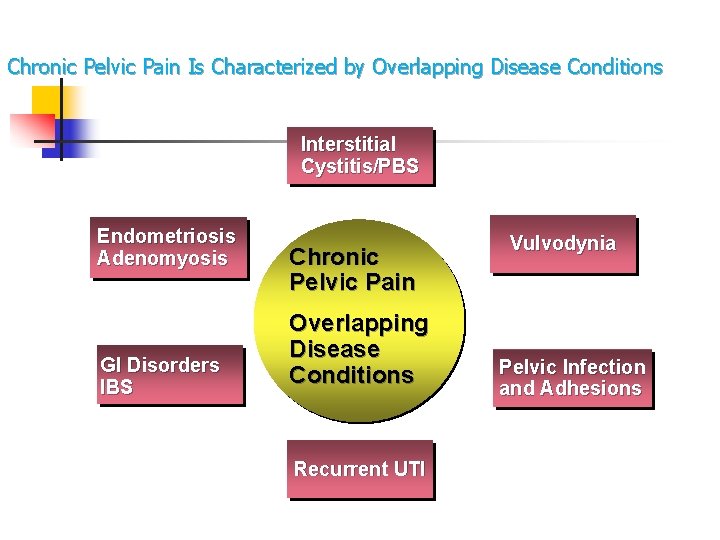 Chronic Pelvic Pain Is Characterized by Overlapping Disease Conditions Interstitial Cystitis/PBS Endometriosis Adenomyosis GI Chronic Pelvic Pain Is Characterized by Overlapping Disease Conditions Interstitial Cystitis/PBS Endometriosis Adenomyosis GI