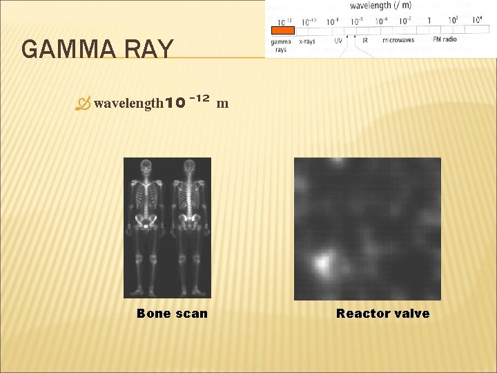 GAMMA RAY wavelength 10 -12 Bone scan m Reactor valve 