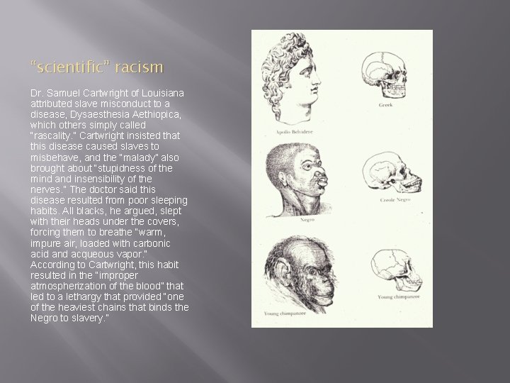 “scientific” racism Dr. Samuel Cartwright of Louisiana attributed slave misconduct to a disease, Dysaesthesia