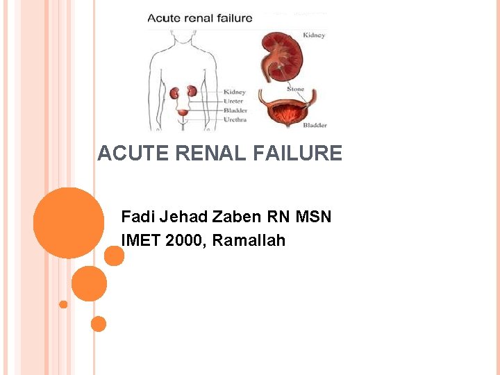 ACUTE RENAL FAILURE Fadi Jehad Zaben RN MSN IMET 2000, Ramallah 