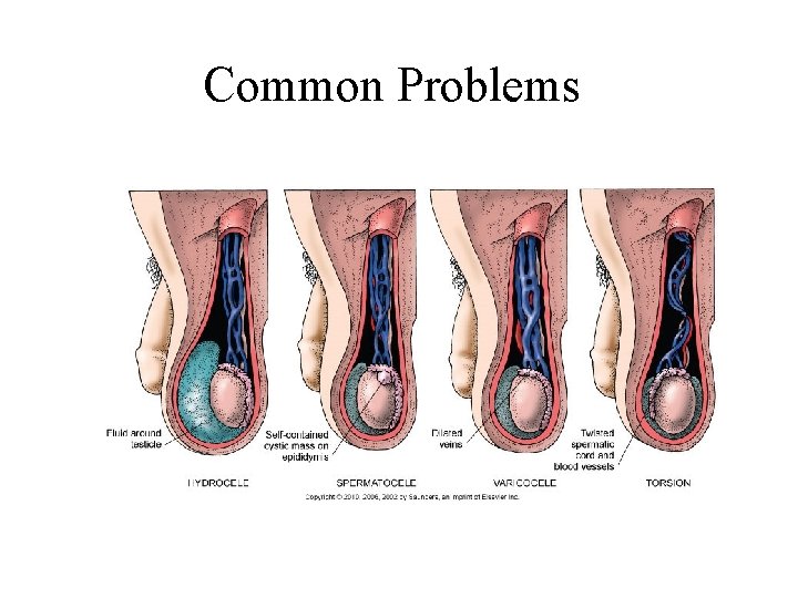 Common Problems Common Problems