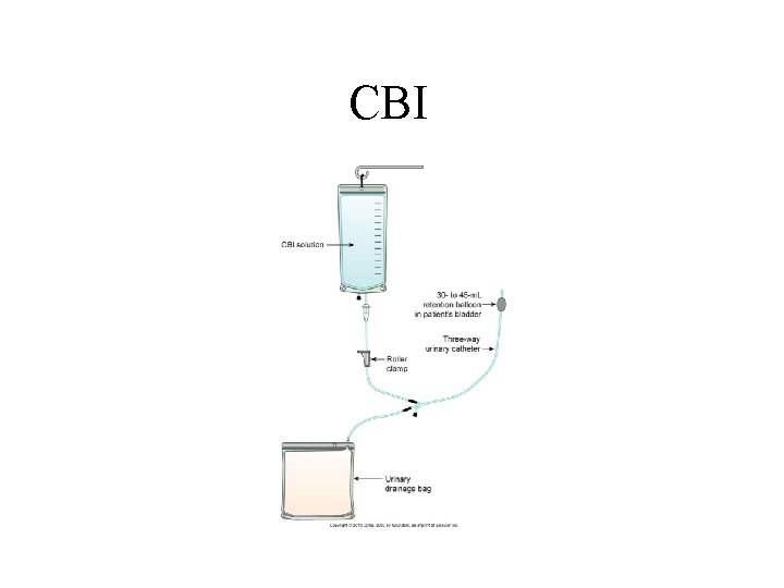 CBI CBI