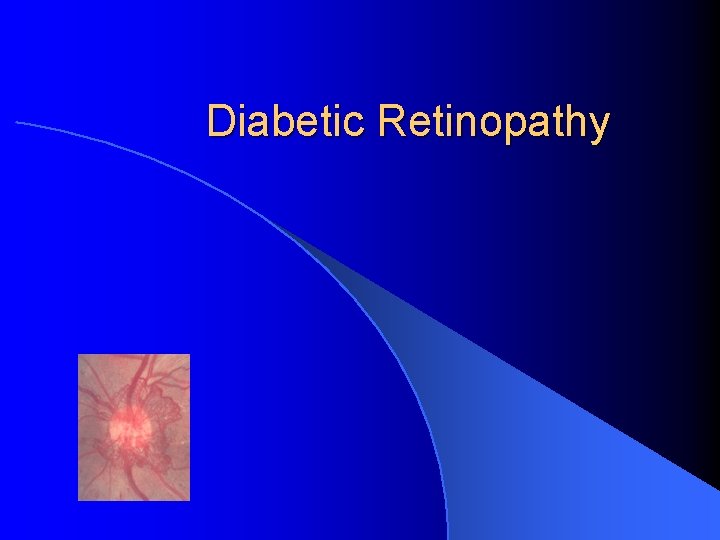 Diabetic Retinopathy 