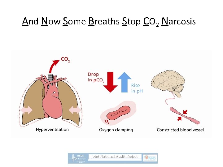 And Now Some Breaths Stop CO 2 Narcosis 