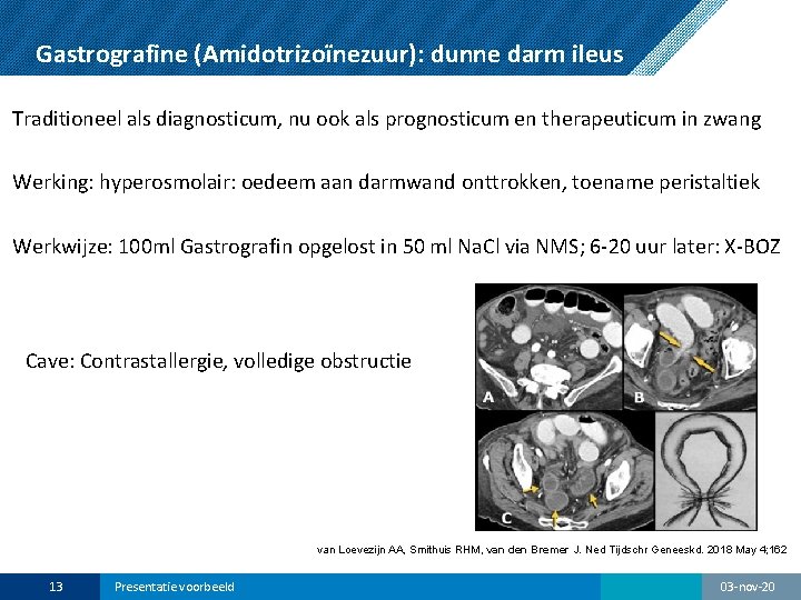 Gastrografine (Amidotrizoïnezuur): dunne darm ileus Traditioneel als diagnosticum, nu ook als prognosticum en therapeuticum