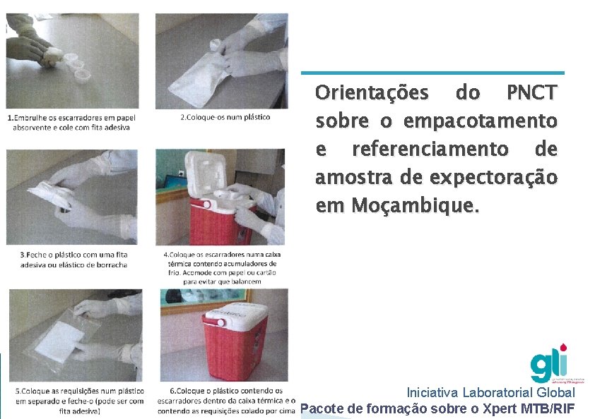Orientações do PNCT sobre o empacotamento e referenciamento de amostra de expectoração em Moçambique. Orientações do PNCT sobre o empacotamento e referenciamento de amostra de expectoração em Moçambique.