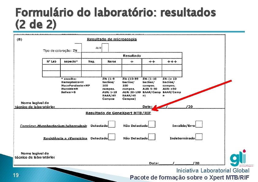 Formulário do laboratório: resultados (2 de 2) -19 - Iniciativa Laboratorial Global Pacote de Formulário do laboratório: resultados (2 de 2) -19 - Iniciativa Laboratorial Global Pacote de