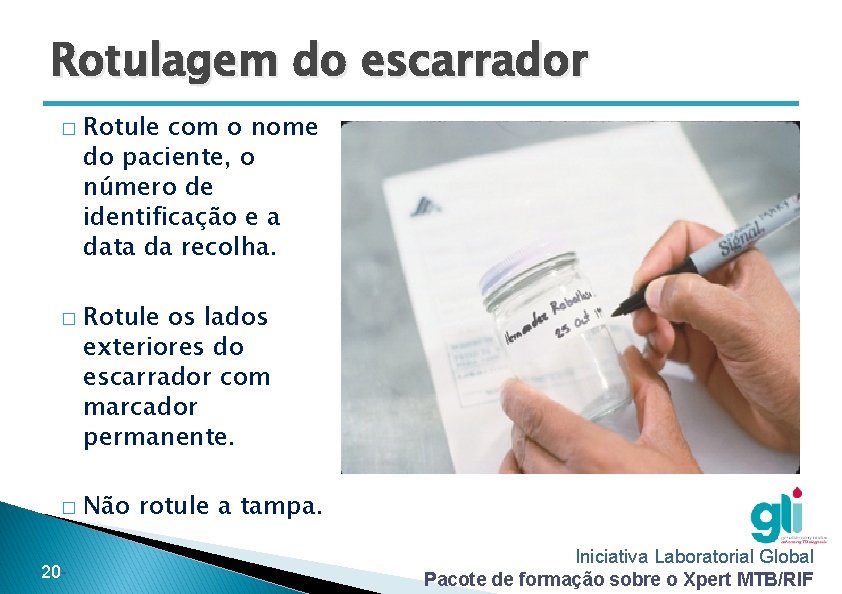 Rotulagem do escarrador � � � -20 - Rotule com o nome do paciente, Rotulagem do escarrador � � � -20 - Rotule com o nome do paciente,