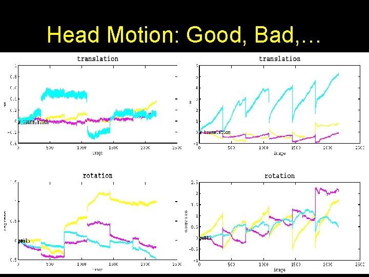 Head Motion: Good, Bad, … 