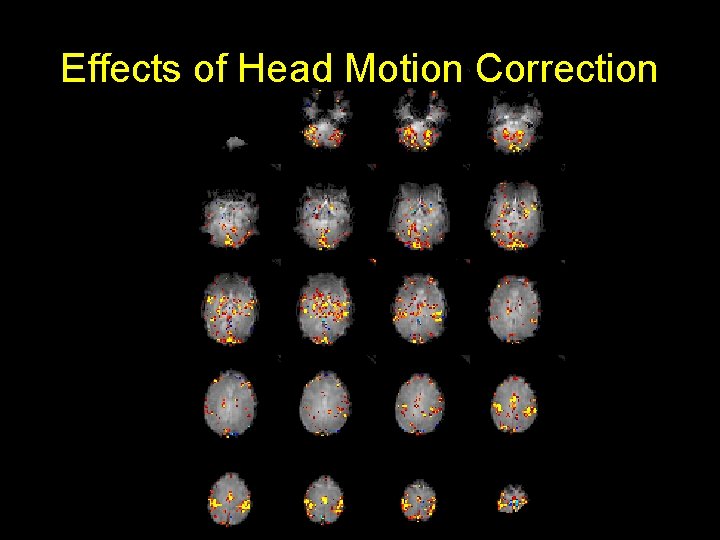 Effects of Head Motion Correction 