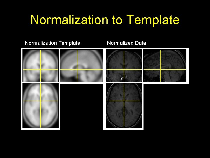 Normalization to Template Normalization Template Normalized Data 