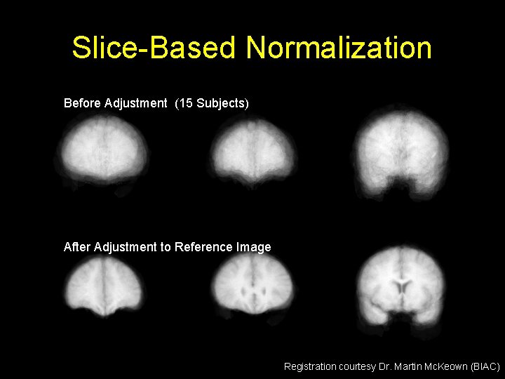 Slice-Based Normalization Before Adjustment (15 Subjects) After Adjustment to Reference Image Registration courtesy Dr.