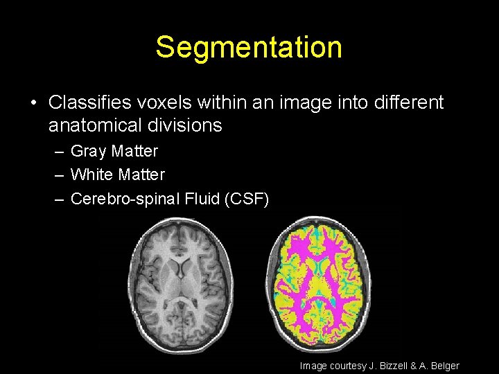 Segmentation • Classifies voxels within an image into different anatomical divisions – Gray Matter