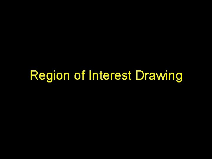 Region of Interest Drawing 