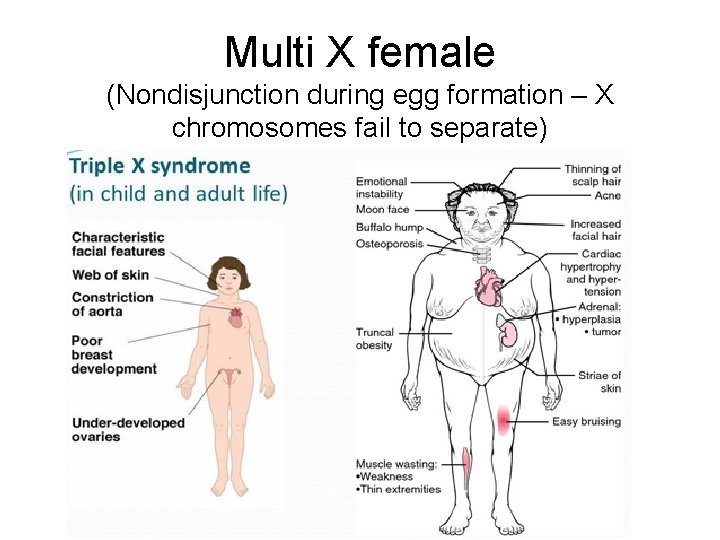 Multi X female (Nondisjunction during egg formation – X chromosomes fail to separate) 