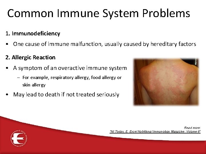 Common Immune System Problems 1. Immunodeficiency • One cause of immune malfunction, usually caused