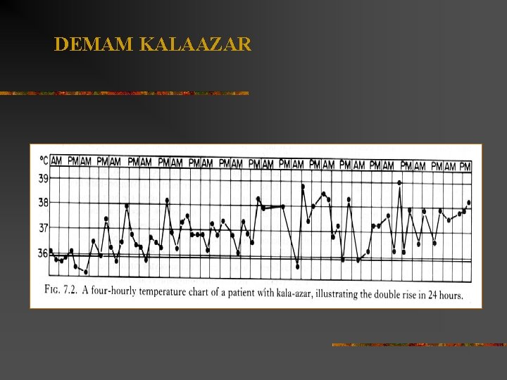 DEMAM KALAAZAR 