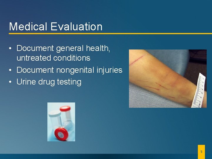 Medical Evaluation • Document general health, untreated conditions • Document nongenital injuries • Urine