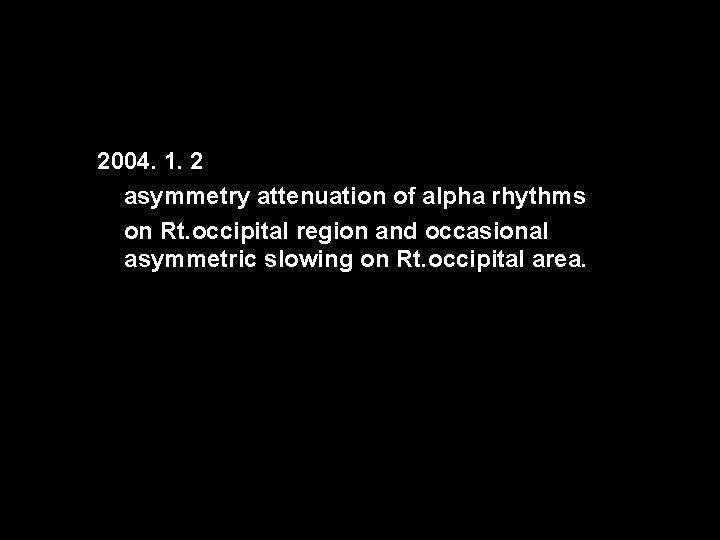 2004. 1. 2 asymmetry attenuation of alpha rhythms on Rt. occipital region and occasional