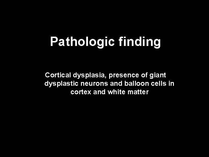 Pathologic finding Cortical dysplasia, presence of giant dysplastic neurons and balloon cells in cortex
