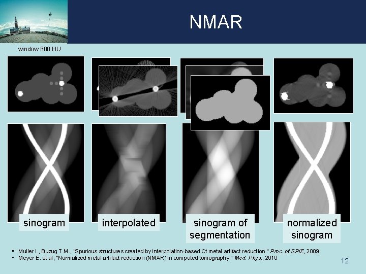 NMAR window 600 HU sinogram interpolated sinogram of segmentation normalized sinogram • Muller I.