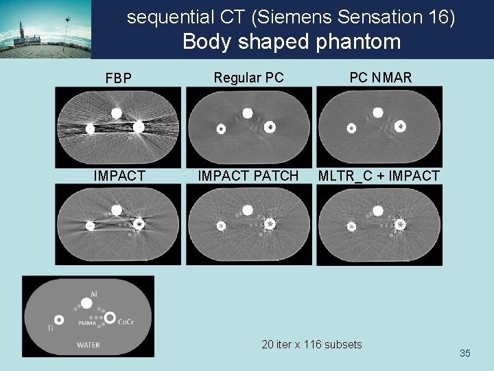 sequential CT (Siemens Sensation 16) Body shaped phantom FBP Regular PC PC NMAR IMPACT