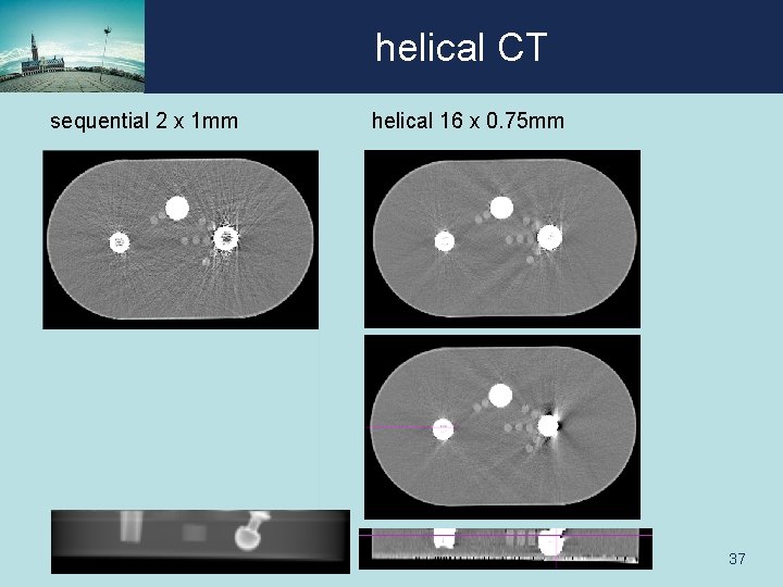 helical CT sequential 2 x 1 mm helical 16 x 0. 75 mm 37