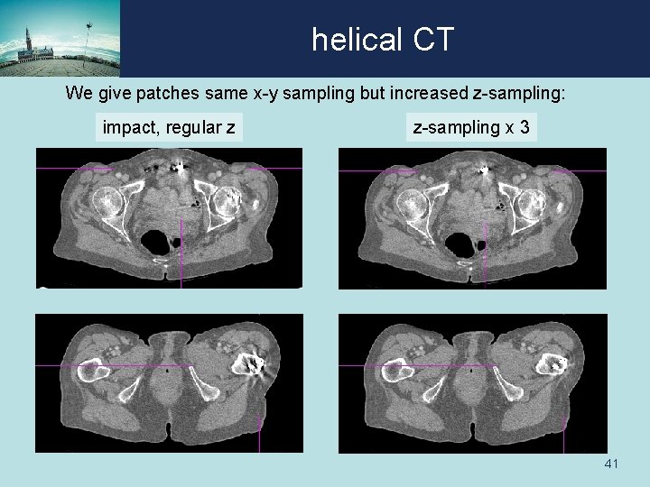 helical CT We give patches same x-y sampling but increased z-sampling: impact, regular z