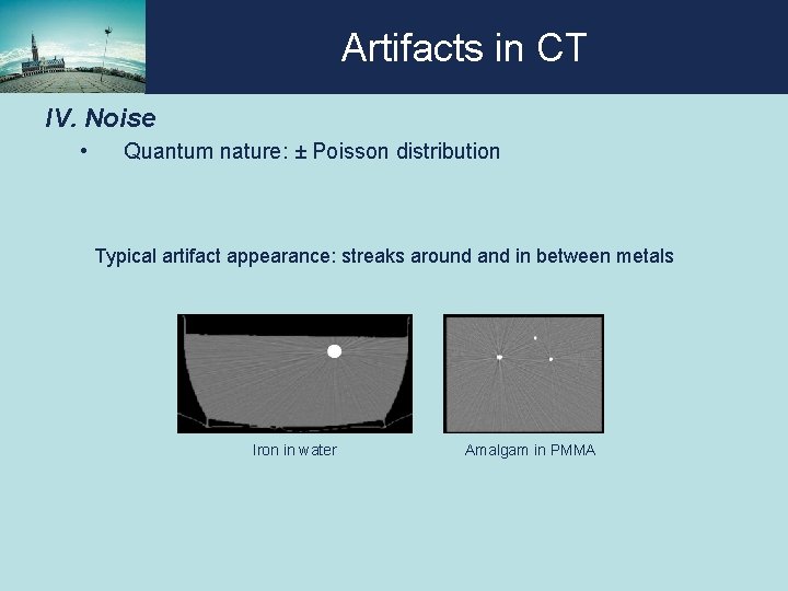 Artifacts in CT IV. Noise • Quantum nature: ± Poisson distribution Typical artifact appearance: