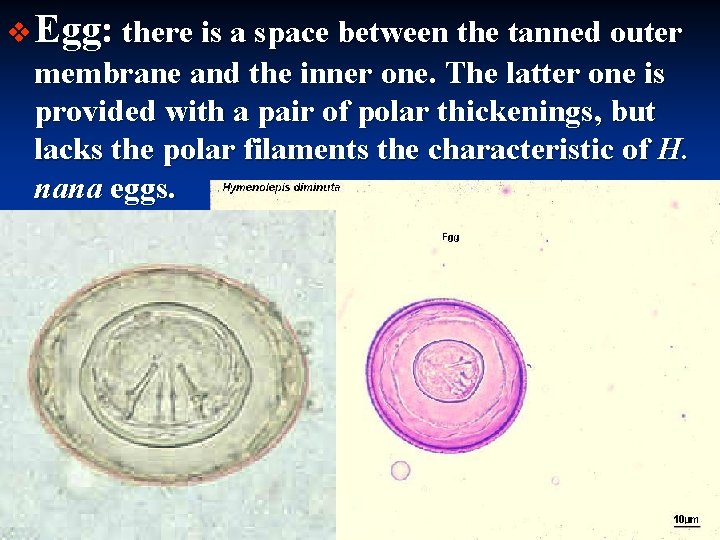 v Egg: there is a space between the tanned outer membrane and the inner