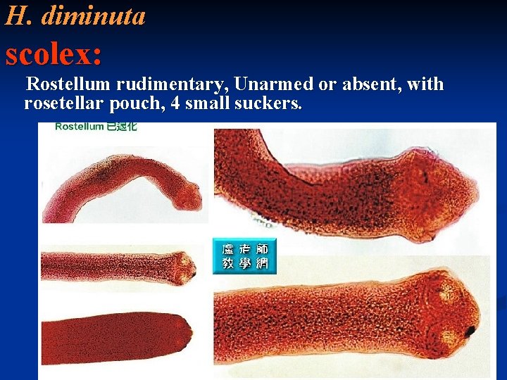 H. diminuta scolex: Rostellum rudimentary, Unarmed or absent, with rosetellar pouch, 4 small suckers.