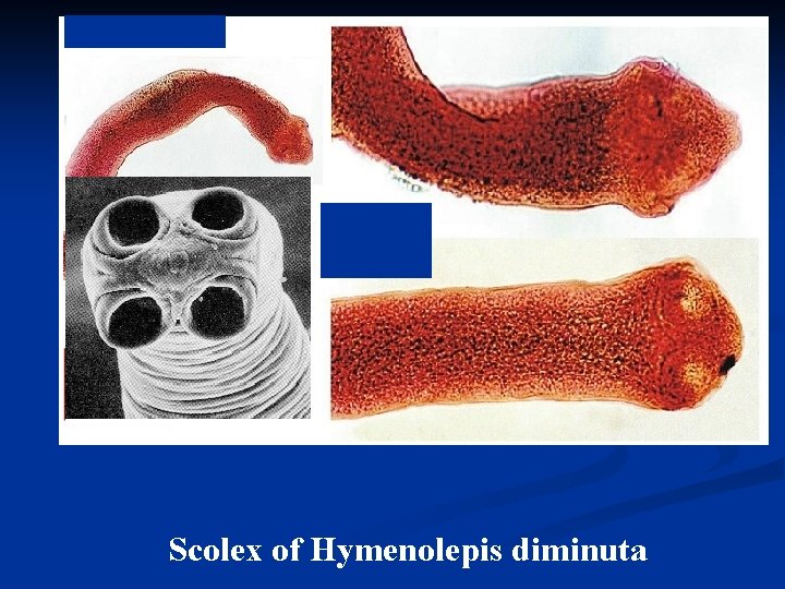 Scolex of Hymenolepis diminuta 