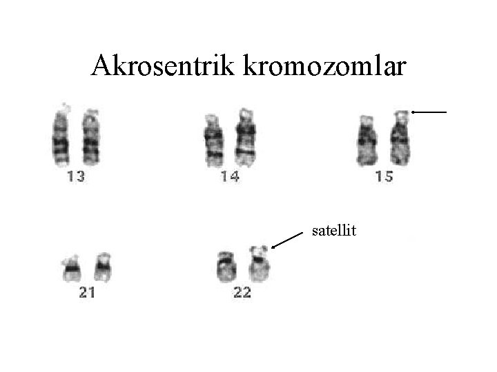 Akrosentrik kromozomlar satellit Akrosentrik kromozomlar satellit