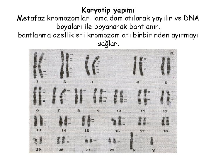 Karyotip yapımı Metafaz kromozomları lama damlatılarak yayılır ve DNA boyaları ile boyanarak bantlanır. bantlanma Karyotip yapımı Metafaz kromozomları lama damlatılarak yayılır ve DNA boyaları ile boyanarak bantlanır. bantlanma