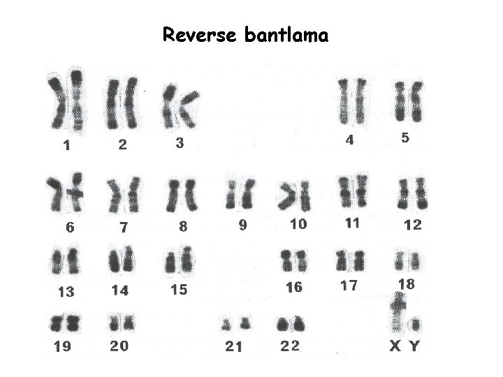 Reverse bantlama 