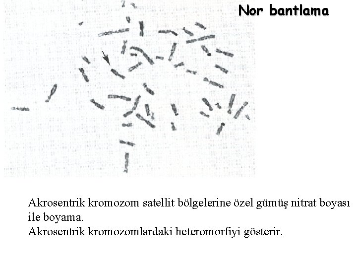 Nor bantlama Akrosentrik kromozom satellit bölgelerine özel gümüş nitrat boyası ile boyama. Akrosentrik kromozomlardaki