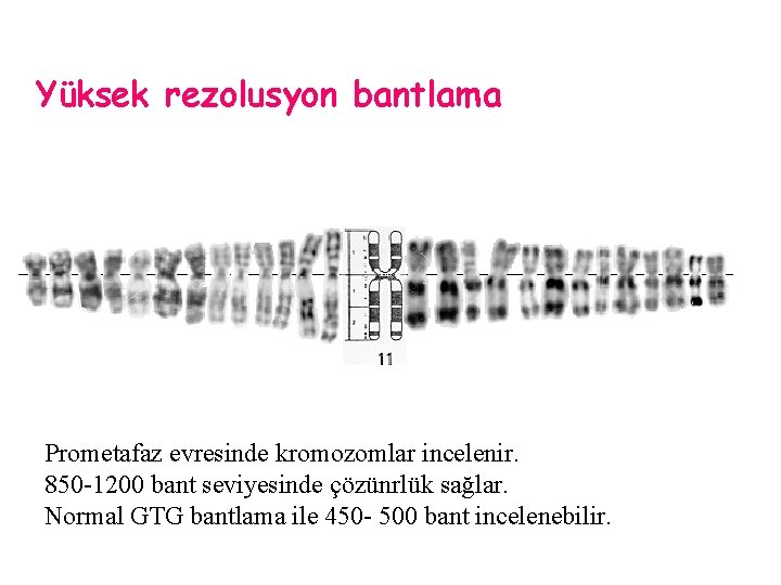 Yüksek rezolusyon bantlama Prometafaz evresinde kromozomlar incelenir. 850 -1200 bant seviyesinde çözünrlük sağlar. Normal