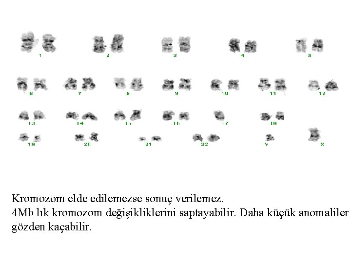 Kromozom elde edilemezse sonuç verilemez. 4 Mb lık kromozom değişikliklerini saptayabilir. Daha küçük anomaliler