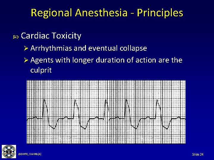 Regional Anesthesia - Principles Cardiac Toxicity Ø Arrhythmias and eventual collapse Ø Agents with