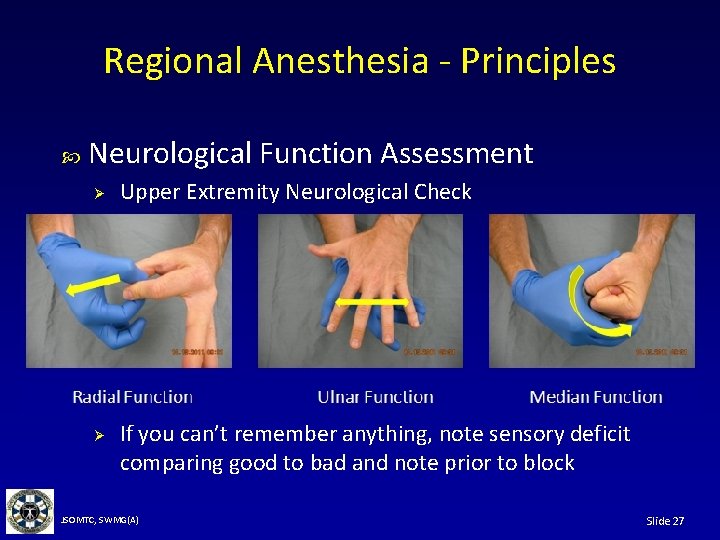 Regional Anesthesia - Principles Neurological Function Assessment Ø Ø Upper Extremity Neurological Check If