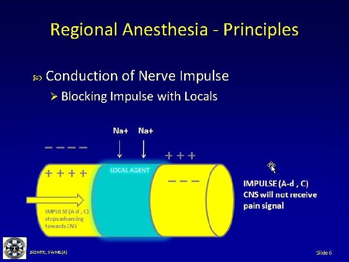 Regional Anesthesia - Principles Conduction of Nerve Impulse Ø Blocking Impulse with Locals JSOMTC,